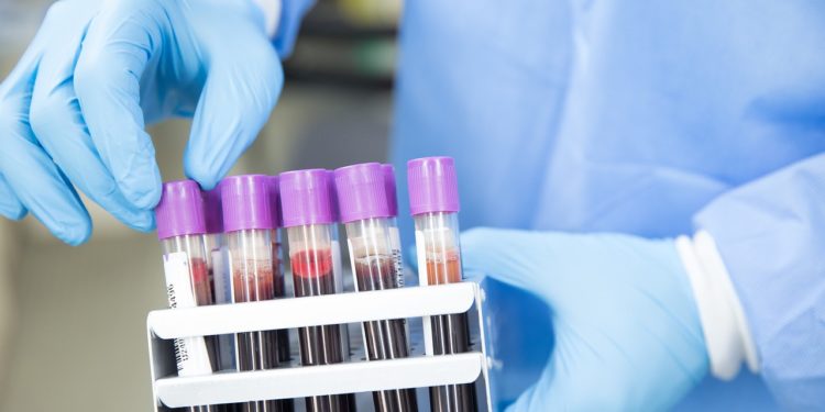 como-se-tornar-doador-de-medula-óssea